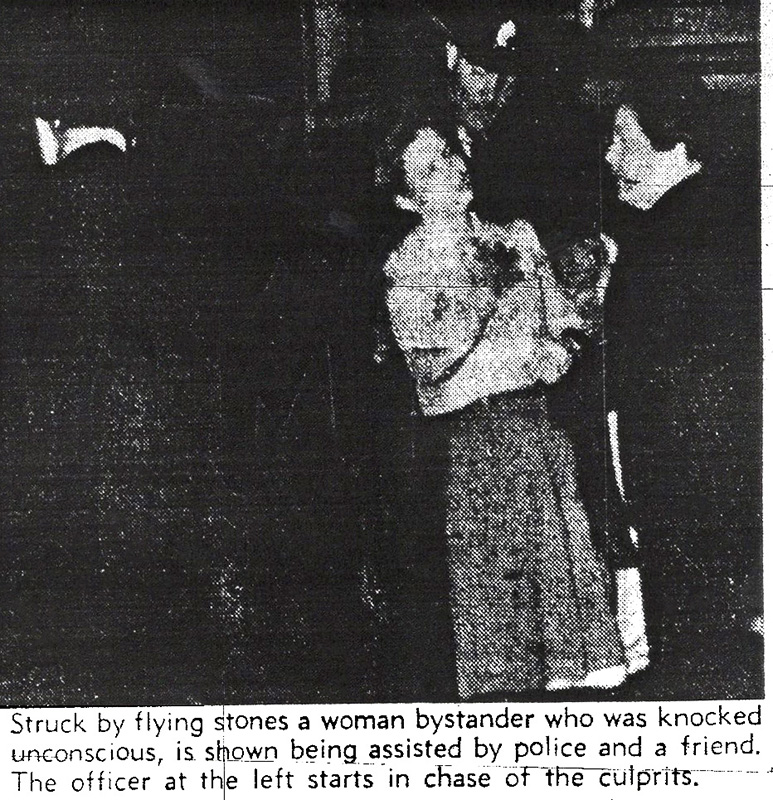 Vancouver's Zoot Suit Riots 12 A bystander injured in the riots. (News-Herald, August 7, 1944)